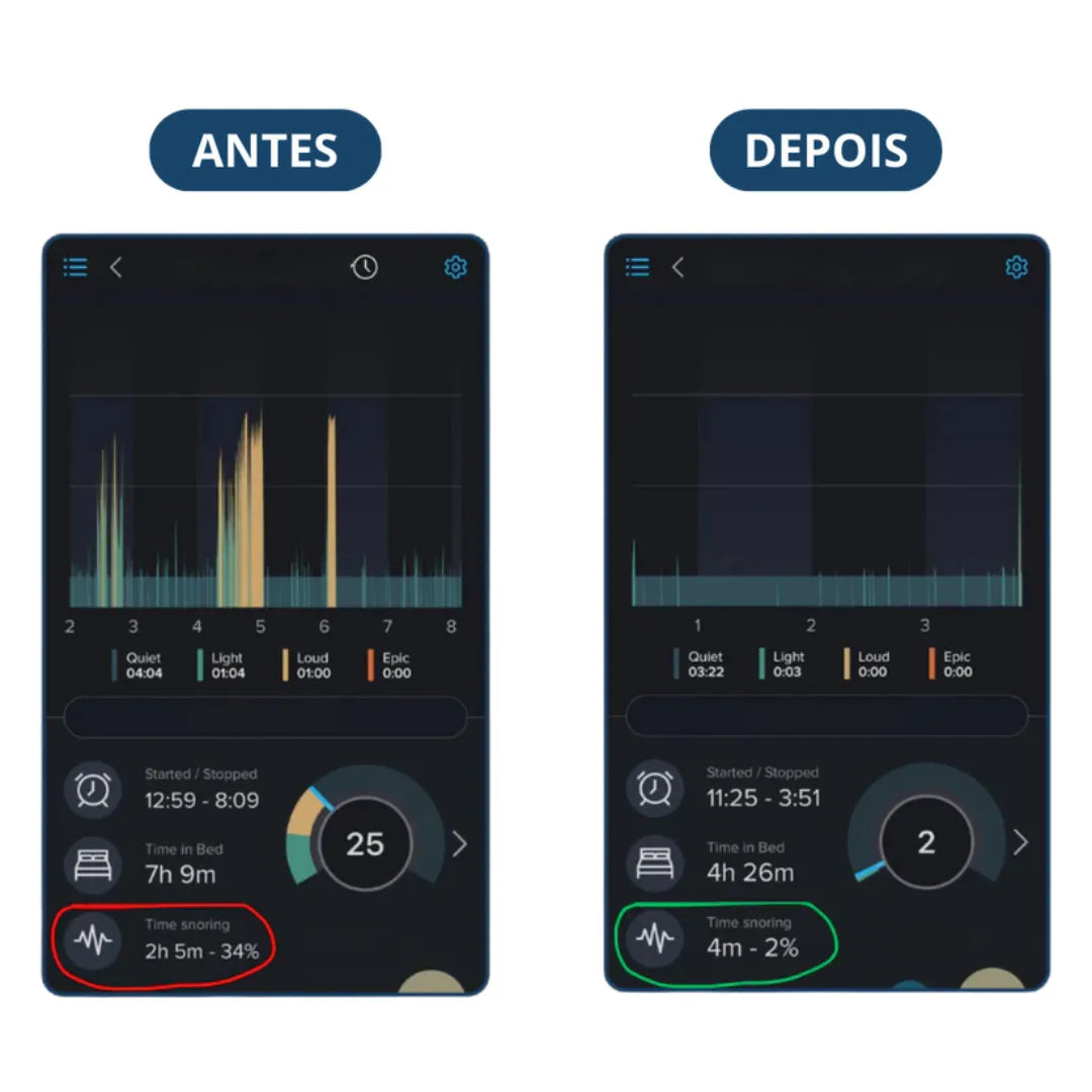 [OFERTAS RELÂMPAGO] Protetor Bucal Anti-Ronco Deep Sleep® - DISPONÍVEL ATÉ AS 23h